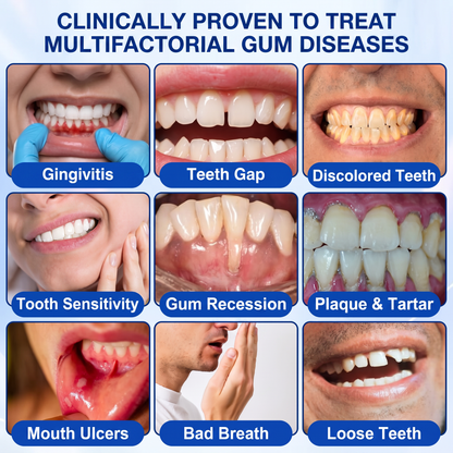 Pureluxo® 🦷  periodontal repair gel 🧑‍⚕️