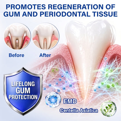 Pureluxo® 🦷  periodontal repair gel 🧑‍⚕️
