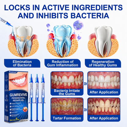 Pureluxo® 🦷  periodontal repair gel 🧑‍⚕️