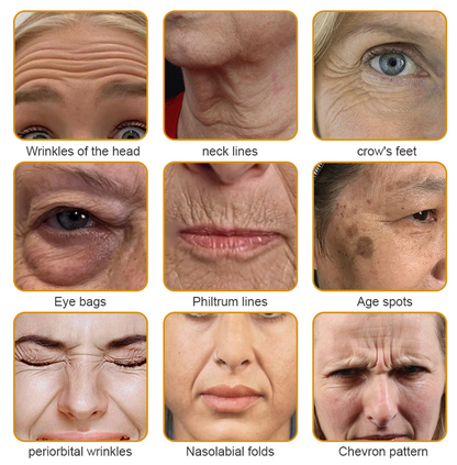 Made and dispatched in the UK✨ 𝗧𝗟𝗢𝗣𝗔® Botox Bee Venom Wrinkle Removal Cream👨‍⚕️𝐌𝐇𝐑𝐀 𝐑𝐞𝐜𝐨𝐦𝐦𝐞𝐧𝐝𝐞𝐝✨LAST DAY 80% OFF