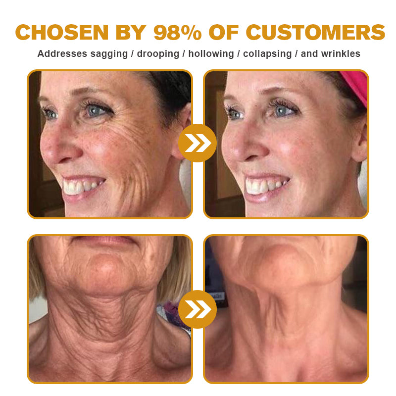 Made and dispatched in the UK✨ 𝗧𝗟𝗢𝗣𝗔® Botox Bee Venom Wrinkle Removal Cream👨‍⚕️𝐌𝐇𝐑𝐀 𝐑𝐞𝐜𝐨𝐦𝐦𝐞𝐧𝐝𝐞𝐝✨LAST DAY 80% OFF