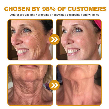 Made and dispatched in the UK✨ 𝗧𝗟𝗢𝗣𝗔® Botox Bee Venom Wrinkle Removal Cream👨‍⚕️𝐌𝐇𝐑𝐀 𝐑𝐞𝐜𝐨𝐦𝐦𝐞𝐧𝐝𝐞𝐝✨LAST DAY 80% OFF